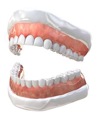 Dentures in Palatine, IL