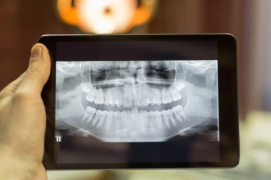 Digital radiography equipment for low-radiation dental x-rays at Regency Dental Care in Palatine, IL