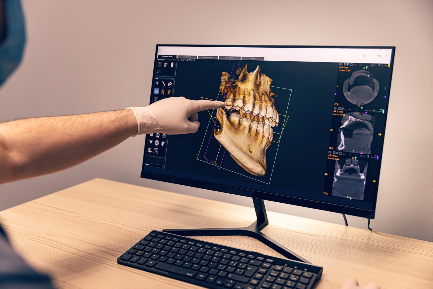 Dentist reviewing a 3D dental scan on screen at Regency Dental Care